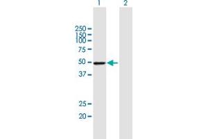 Western Blot analysis of PSMD4 expression in transfected 293T cell line by PSMD4 MaxPab polyclonal antibody. (PSMD4/ASF antibody  (AA 1-377))