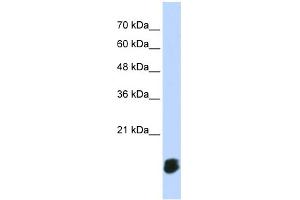 WB Suggested Anti-GLRX5 Antibody Titration: 0.