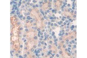 Figure. (Peroxiredoxin 3 antibody  (AA 64-257))