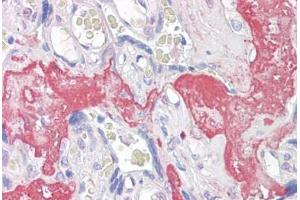 Anti-GAGED2 antibody IHC staining of human placenta. (XAGE1D antibody  (AA 58-69))