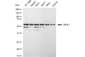 anti-Transducin (Beta)-Like 1 X-Linked Receptor 1 (TBL1XR1) antibody