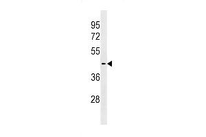 Western blot analysis in ZR-75-1 cell line lysates (35ug/lane). (SLC30A10 antibody  (C-Term))