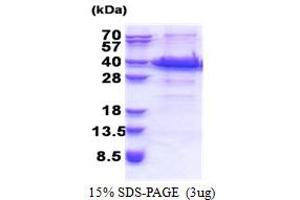 SDS-PAGE (SDS) image for Acyl-CoA Binding Domain Containing 6 (ACBD6) (AA 1-282) protein (His tag) (ABIN5853315)