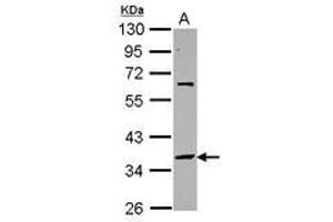 Image no. 1 for anti-Small Nuclear RNA Activating Complex, Polypeptide 2, 45kDa (SNAPC2) (AA 60-290) antibody (ABIN1501022) (SNAPC2 antibody  (AA 60-290))