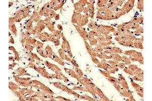 Immunohistochemistry of paraffin-embedded human heart tissue using ABIN7145355 at dilution of 1:100 (ADRB1 antibody  (AA 401-477))