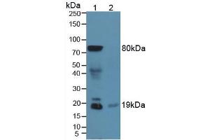 Figure. (Somatostatin antibody  (AA 1-116))