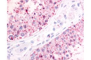Anti-P2RY1 / P2Y1 antibody IHC of human testis. (P2RY1 antibody  (N-Term))