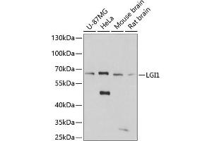 Western blot analysis of extracts of various cell lines, using LGI1 antibody (ABIN7268237) at 1:3000 dilution. (LGI1 antibody  (AA 301-557))
