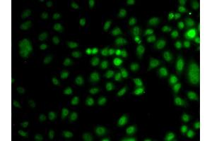 Immunofluorescence analysis of A549 cells using TRPS1 antibody (ABIN5974943). (TRPS1 antibody)