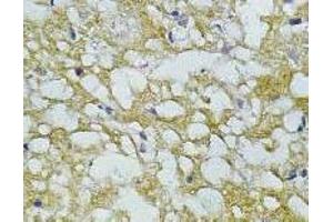 Immunohistochemistry (IHC) image for anti-Synaptophysin (SYP) antibody (ABIN1109181) (Synaptophysin antibody)