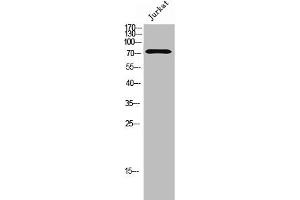 Western Blot analysis of Jurkat cells using FoxK1 Polyclonal Antibody (Foxk1 antibody  (C-Term))