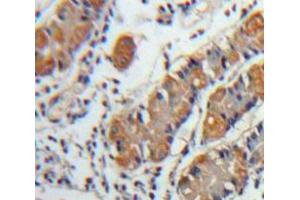 IHC-P analysis of Stomach tissue, with DAB staining. (CXCL5 antibody  (AA 45-118))