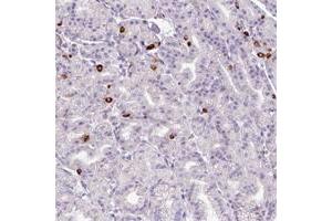 Immunohistochemical staining of human cerebral cortex with ASB1 polyclonal antibody  shows strong cytoplasmic positivity in neuronal cells and glial cells at 1:50-1:200 dilution.