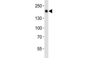 Western blot analysis of lysate from mouse liver tissue using Egfr antibody diluted at 1:1000.