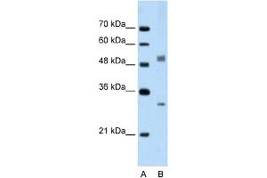 WB Suggested Anti-IRF6 Antibody Titration:  2. (IRF6 antibody  (C-Term))