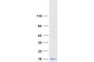 Validation with Western Blot (CST2 Protein (Myc-DYKDDDDK Tag))