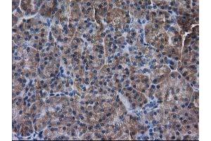 Immunohistochemical staining of paraffin-embedded Human pancreas tissue using anti-DSTN mouse monoclonal antibody. (Destrin antibody)