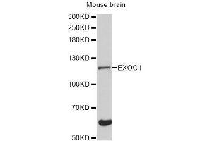 Western blot analysis of extracts of mouse brain, using EXOC1 Antibody (ABIN5996713) at 1:3000 dilution.