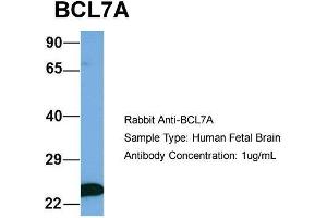 Host: Rabbit  Target Name: BCL7A  Sample Tissue: Human Fetal Brain  Antibody Dilution: 1. (BCL7A antibody  (Middle Region))