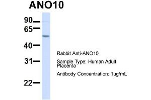 Host:  Rabbit  Target Name:  ANO10  Sample Type:  Human Adult Placenta  Antibody Dilution:  1. (Anoctamin 10 antibody  (C-Term))