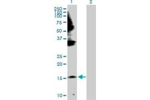 Western Blot analysis of GEMIN6 expression in transfected 293T cell line by GEMIN6 MaxPab polyclonal antibody. (GEMIN6 antibody  (AA 1-167))