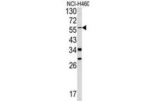 Western blot analysis of Y antibody (C-term) (ABIN390480 and ABIN2840844) in NCI- cell line lysates (35 μg/lane). (YAP1 antibody  (C-Term))