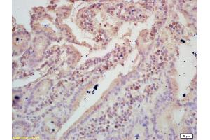 Formalin-fixed and paraffin embedded mouse intestine labeled with Rabbit Anti TIGAR Polyclonal Antibody, Unconjugated (ABIN671286) at 1:200 followed by conjugation to the secondary antibody and DAB staining (TIGAR antibody  (AA 161-270))