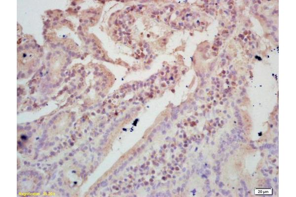 TIGAR antibody  (AA 161-270)