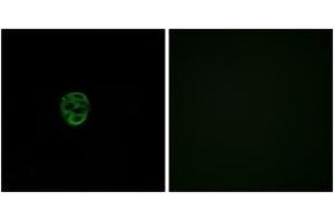 Immunofluorescence analysis of A549 cells, using OR2AE1 Antibody. (Olfactory Receptor, Family 2, Subfamily AE, Member 1 (OR2AE1) (AA 231-280) antibody)