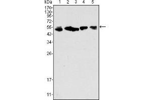 Western blot analysis using CK8 mouse mAb against A549 (1), Hela (2), MCF-7 (3), A431 (4) and HepG2 (5) cell lysate. (KRT8 antibody)