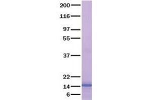 Validation with Western Blot (CCL21 Protein)