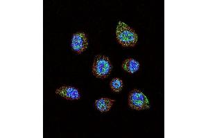 Confocal immunofluorescent analysis of HIF1Alpha Antibody (C-term) (ABIN392176 and ABIN2841888) with MDA-M cell followed by Alexa Fluor 488-conjugated goat anti-rabbit lgG (green). (HIF1A antibody  (C-Term))