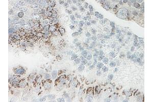 Image no. 3 for anti-Chemokine (C-X-C Motif) Ligand 1 (Melanoma Growth Stimulating Activity, Alpha) (CXCL1) antibody (ABIN464981) (CXCL1 antibody)