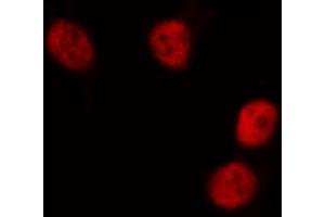 ABIN6268834 staining HeLa cells by IF/ICC. (DUSP1 antibody  (C-Term))