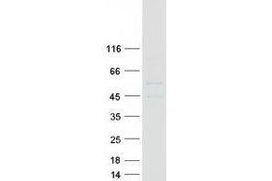 Western Blotting (WB) image for Choline/ethanolamine phosphotransferase 1 (CEPT1) (Transcript Variant 2) protein (Myc-DYKDDDDK Tag) (ABIN2718537)