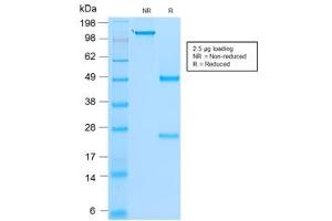 SDS-PAGE analysis of purified, BSA-free recombinant MyoD1 antibody (clone rMYD712) as confirmation of integrity and purity.
