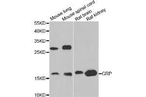 Western blot analysis of extracts of various cell lines, using GRP antibody (ABIN5973785) at 1/1000 dilution. (Gastrin-Releasing Peptide antibody)