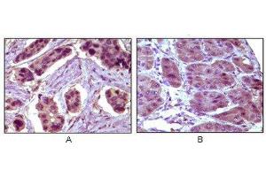 Immunohistochemistry (IHC) image for anti-B-Cell CLL/lymphoma 10 (BCL10) antibody (ABIN1842926) (BCL10 antibody)