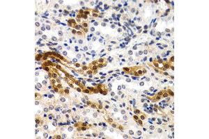 Immunohistochemistry of paraffin-embedded rat kidney using MT2A antibody at dilution of 1:200 (400x lens). (MT2A antibody)