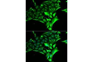 Immunofluorescence analysis of MCF-7 cells using PYGB antibody. (PYGB antibody  (AA 544-843))