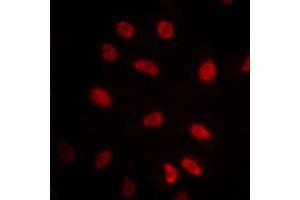 Immunofluorescent analysis of GRP75 staining in NIH3T3 cells. (HSPA9 antibody  (C-Term))