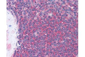 Anti-LCK antibody IHC of human spleen. (LCK antibody  (AA 22-36))