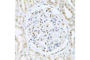 Immunohistochemistry (IHC) image for anti-Core-Binding Factor, beta Subunit (CBFB) (AA 1-182) antibody (ABIN6138000)