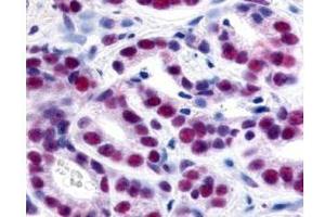 Immunohistochemistry (IHC) image for anti-Histone Deacetylase 1 (HDAC1) (AA 450-482) antibody (ABIN129652)