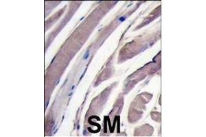 Formalin-fixed and paraffin-embedded human skeletal muscle tissue reacted with HK2 antibody (N-term), which was peroxidase-conjugated to the secondary antibody, followed by DAB staining. (Hexokinase 2 antibody  (N-Term))