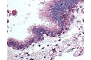 Immunohistochemistry (IHC) image for anti-Histone Deacetylase 4 (HDAC4) (AA 194-209) antibody (ABIN2470109) (HDAC4 antibody  (AA 194-209))