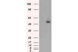 Western Blotting (WB) image for anti-CD36 (CD36) antibody (ABIN1497274)