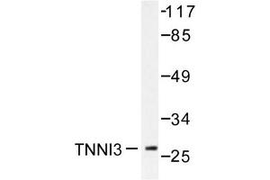 Image no. 1 for anti-Cardiac Troponin I (TNNI3) antibody (ABIN271938) (TNNI3 antibody)