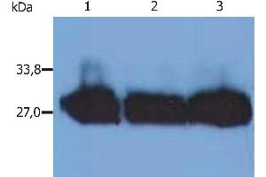 Western Blotting analysis (reducing conditions) of human blood sera using anti-human Immunoglobulin kappa-chain (MEM-09).