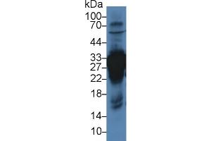 Western blot analysis of Rat Liver lysate, using Rat CA3 Antibody (3 µg/ml) and HRP-conjugated Goat Anti-Rabbit antibody (